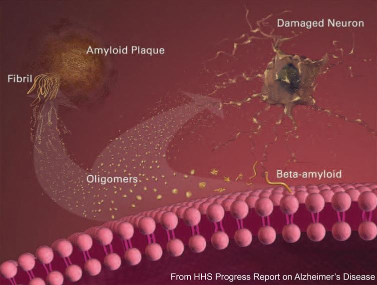#4 The Role of Beta-Amyloid Protein in the Progression and Development of Alzheimer’s Disease that Spans Decades