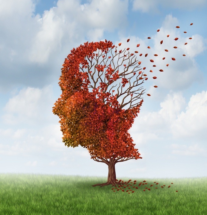 Brain disease with memory loss due to Dementia and Alzheimer's illness with the medical icon of an autumn season color tree in the shape of a human head and brain losing leaves as a concept of intelligence decline.