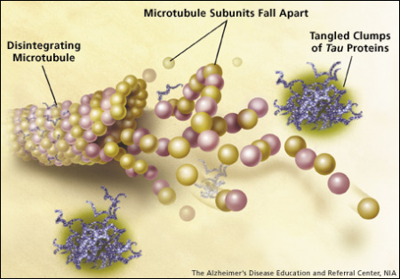 #5 The Role of Tau Protein and Tau Tangles in the Progression and Development of Alzheimer’s Disease
